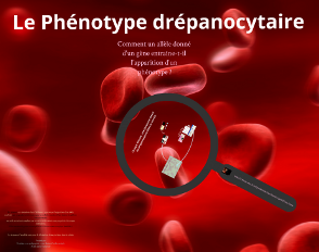 Etude de cas : la drépanocytose